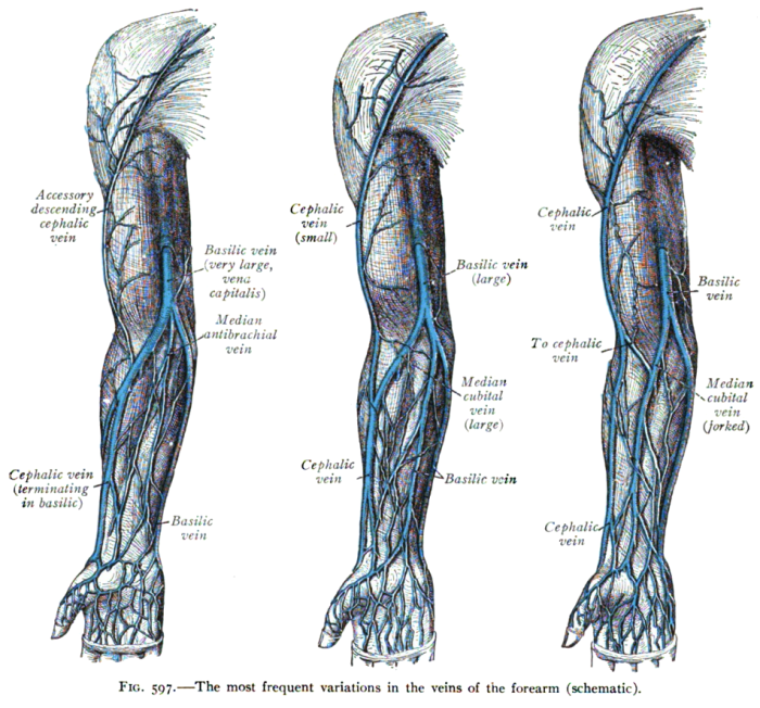 Before after vein treatment varicose