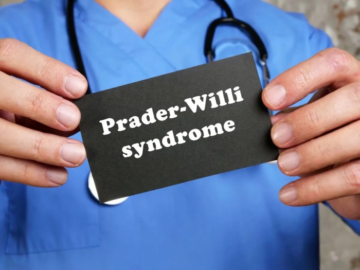 Oldest person with prader-willi syndrome