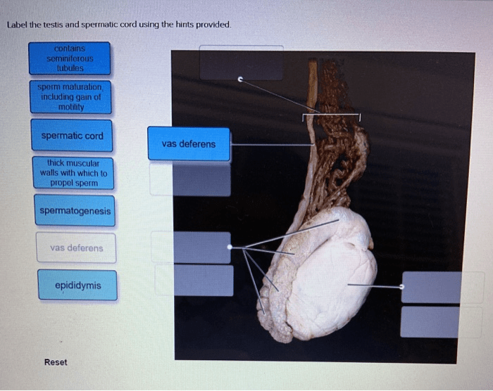 Label the testis and spermatic cord