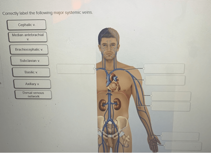 Systemic label major correctly following arteries chegg solved internal transcribed problem text been show has