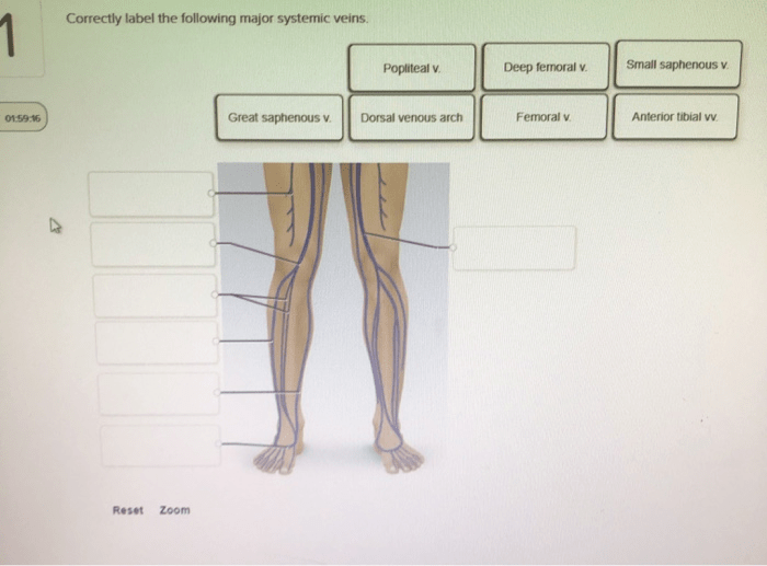 Correctly label the following major systemic veins.